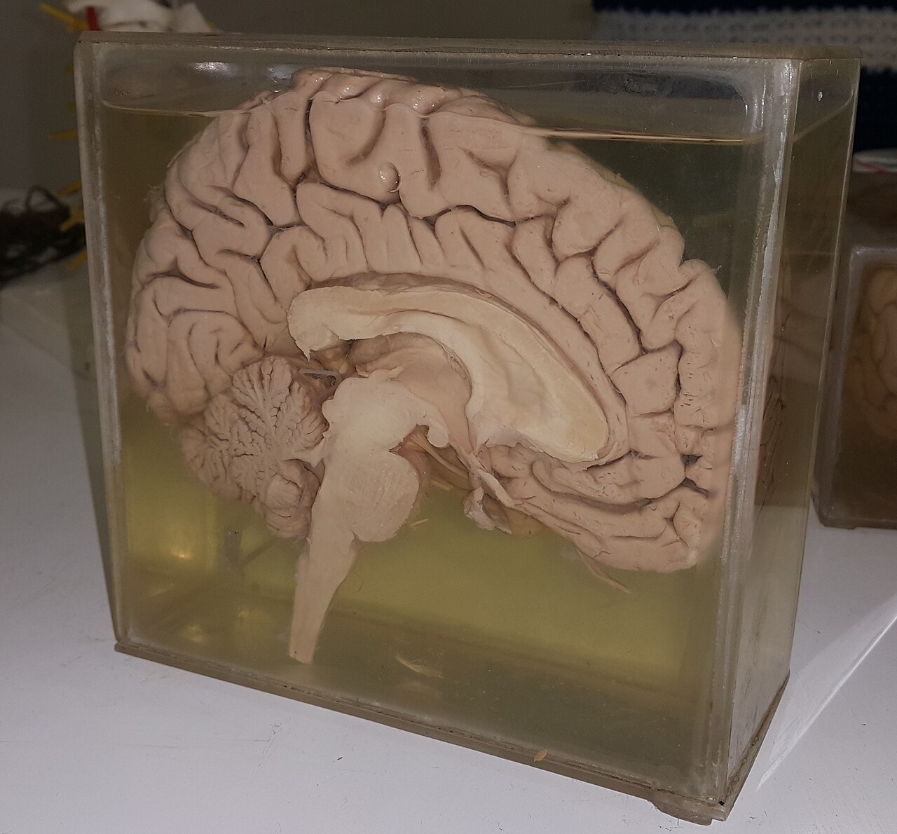 Sagittal section of a human brain.