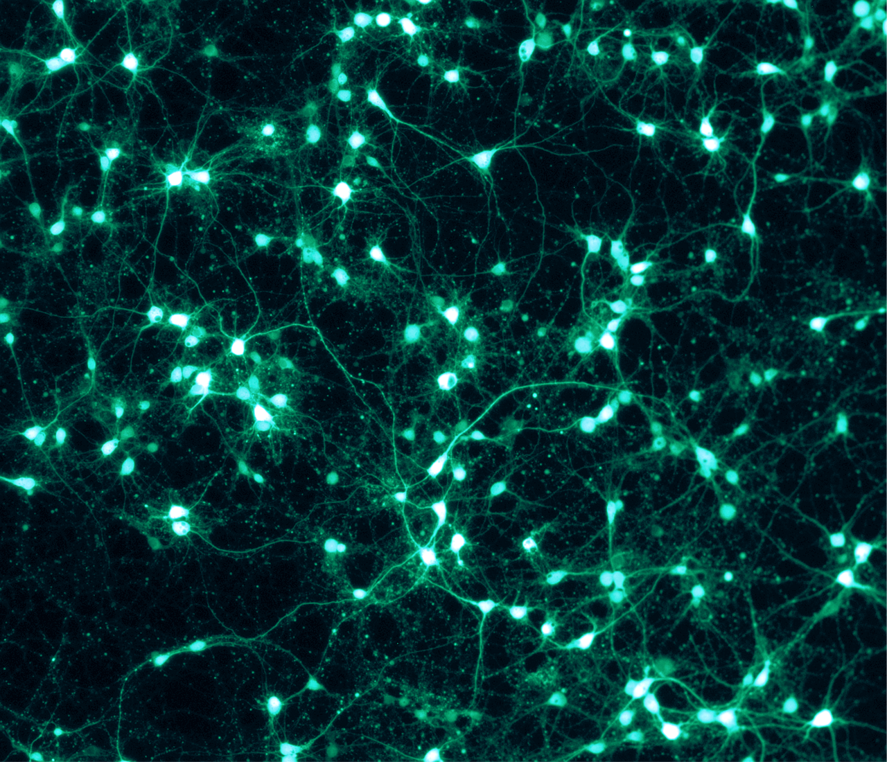 Fluorescentni snimak nervnih ćelija pacova u laboratoriji.