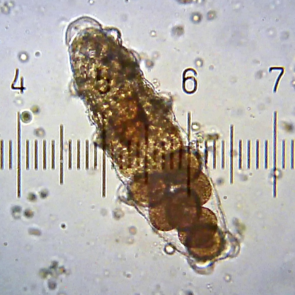 Tardigrade eggs in a shed cuticle.