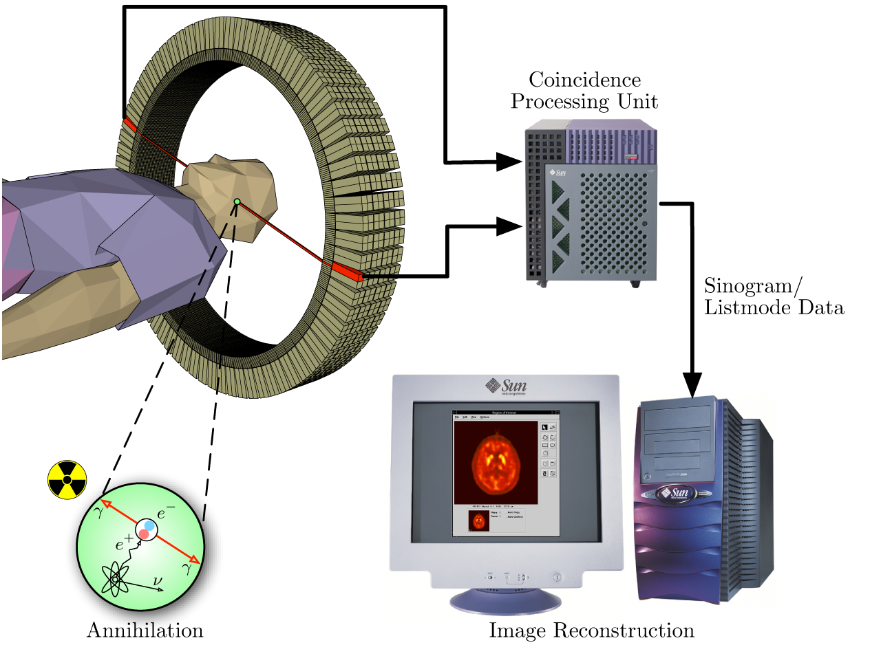 Diagram of PET photon-pair detection